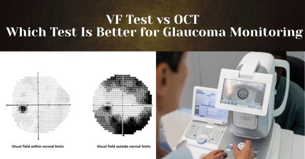 VF Test vs OCT – Which Test Is Better for Glaucoma Monitoring?
