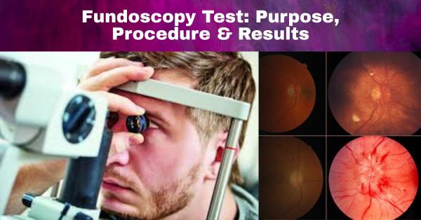 Fundoscopy Test: Purpose, Procedure & Results