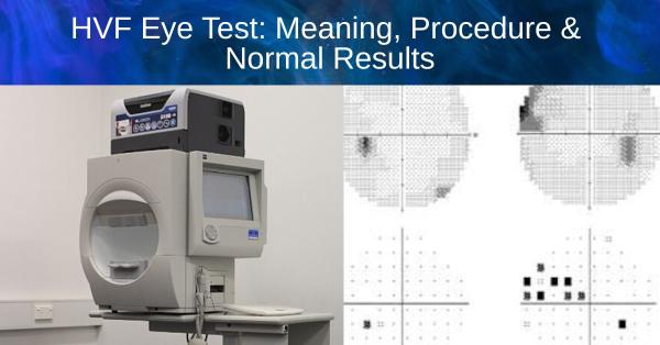 HVF Eye Test: Meaning, Procedure and Normal Results
