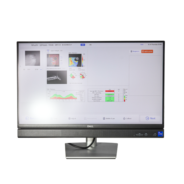 High-Speed Optical Coherence Tomography System