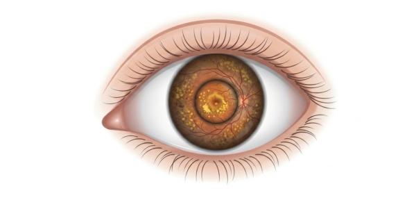 Retinal Disease Detection Machines